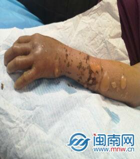 新澳门平特一肖100期开奖结果和女子遭毒蛇咬伤身亡与女子遭毒蛇咬伤身亡视频